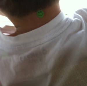 acupuncture apraxia point